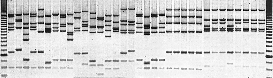 STR profiling_Cancer Epigenetics Society